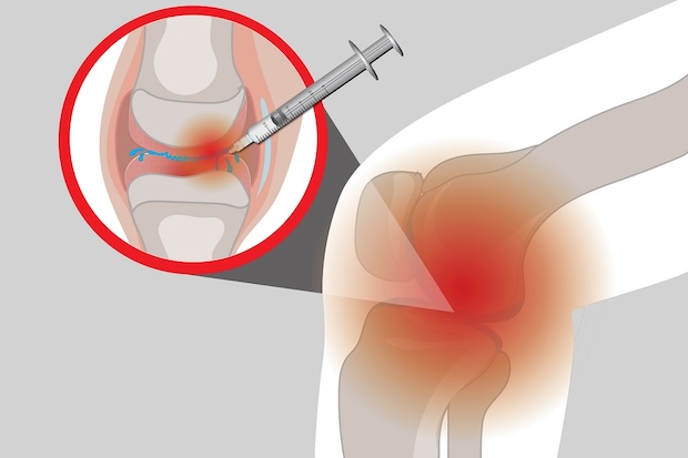 Dr.Özgur Binbaş eklem içi enjeksiyon